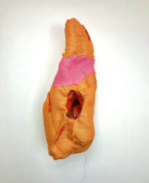 Karin Tuck Petersen Scars